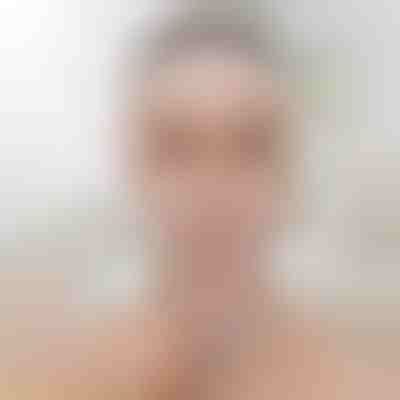 Povzdigovalni trak za oblikovanje obraza | KIMLIFT